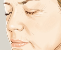 全面部紧肤除皱