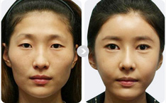时代自体活细胞真人案例