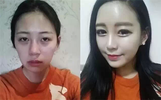 台湾微整形圣手吴政谚 让您颜值爆表
