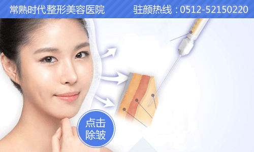 除皱,嫩肤,时代除皱
