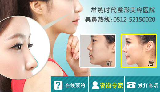 时代,个性化定制隆鼻